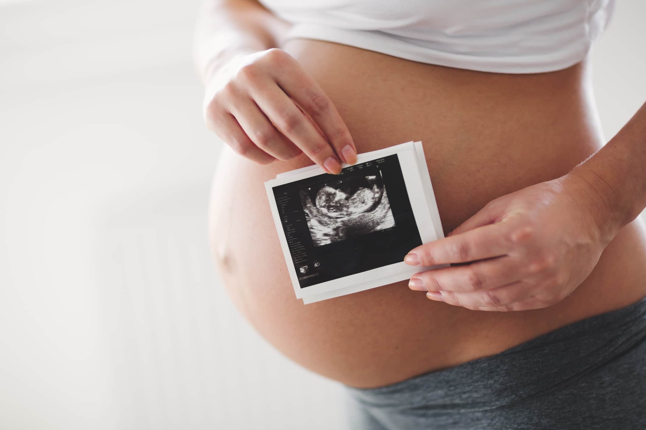  Mulher segurando, junto a barriga, uma foto do Ultrassom