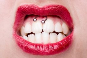 Piercing no smile: Cuidados e dicas